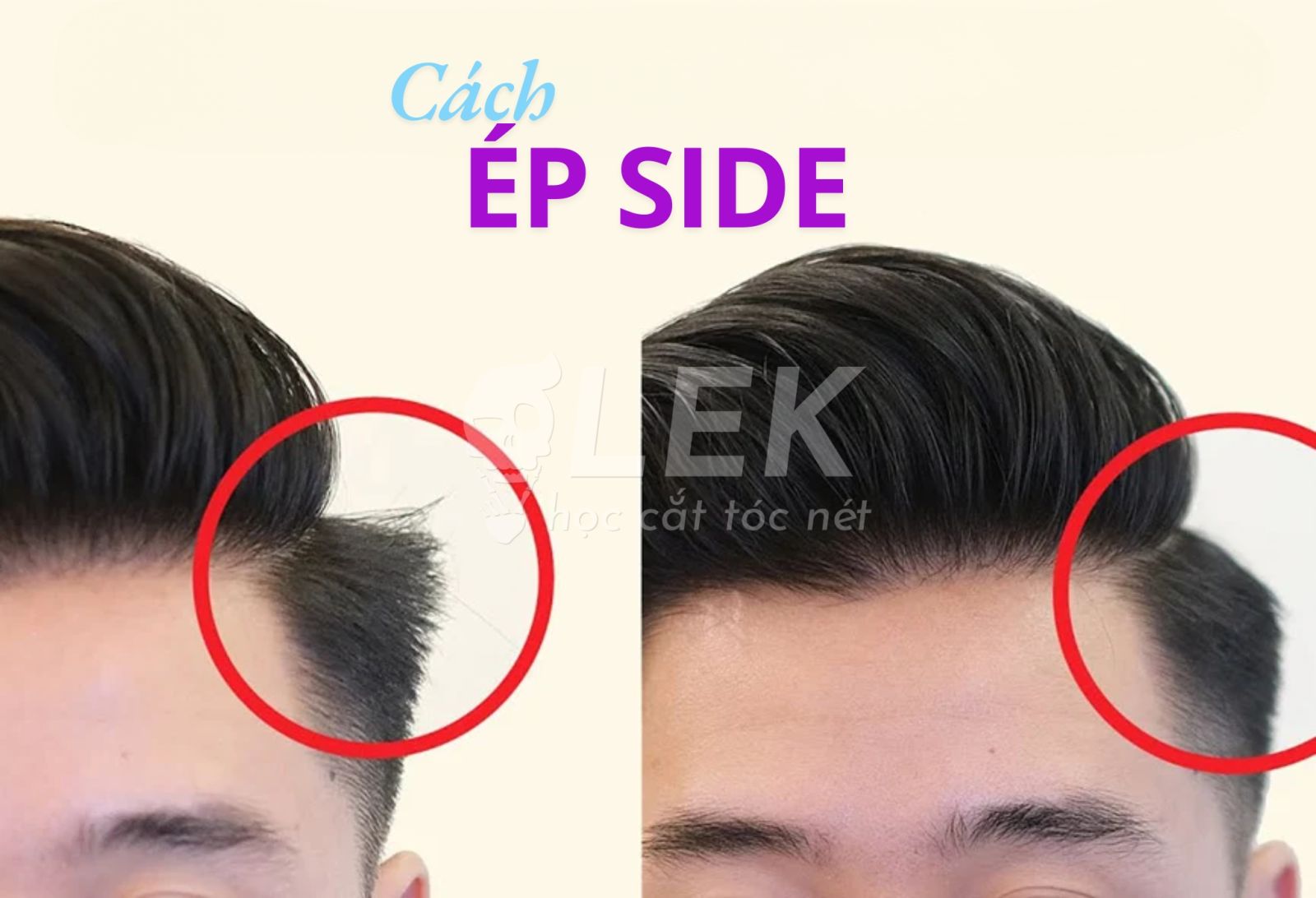 Ép side tóc nam
