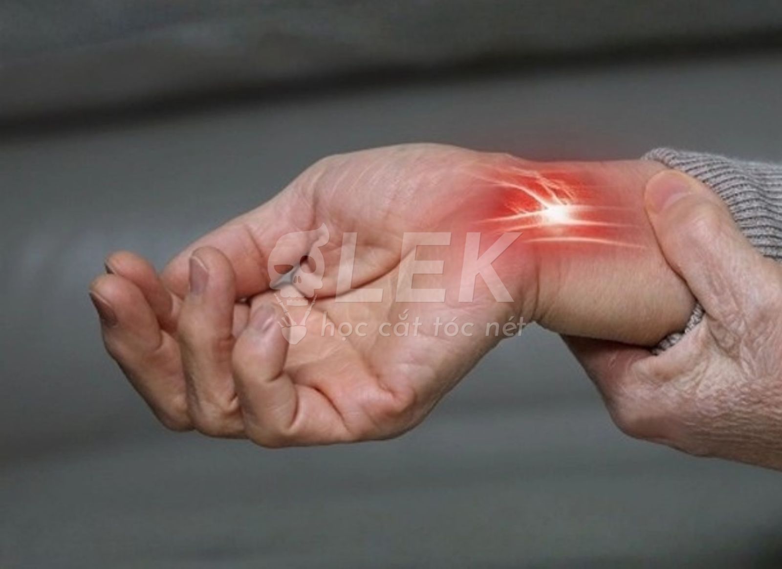 Hội Chứng Ống Cổ Tay