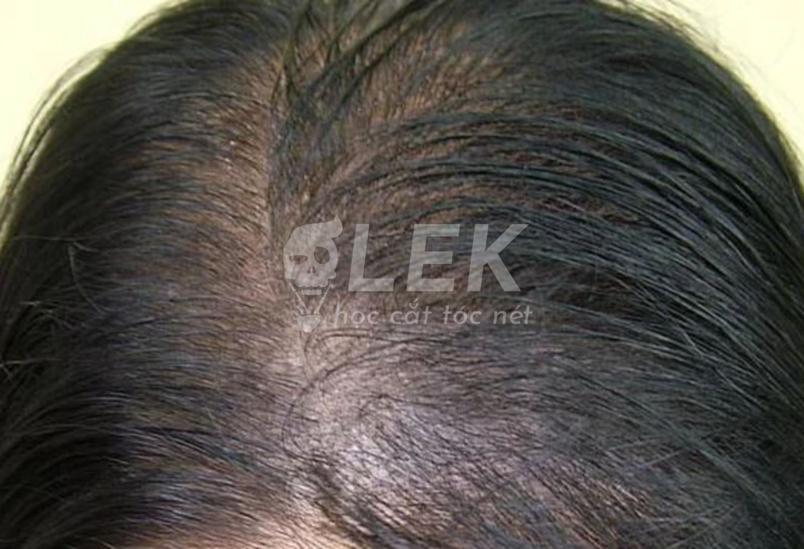 tóc nam mỏng