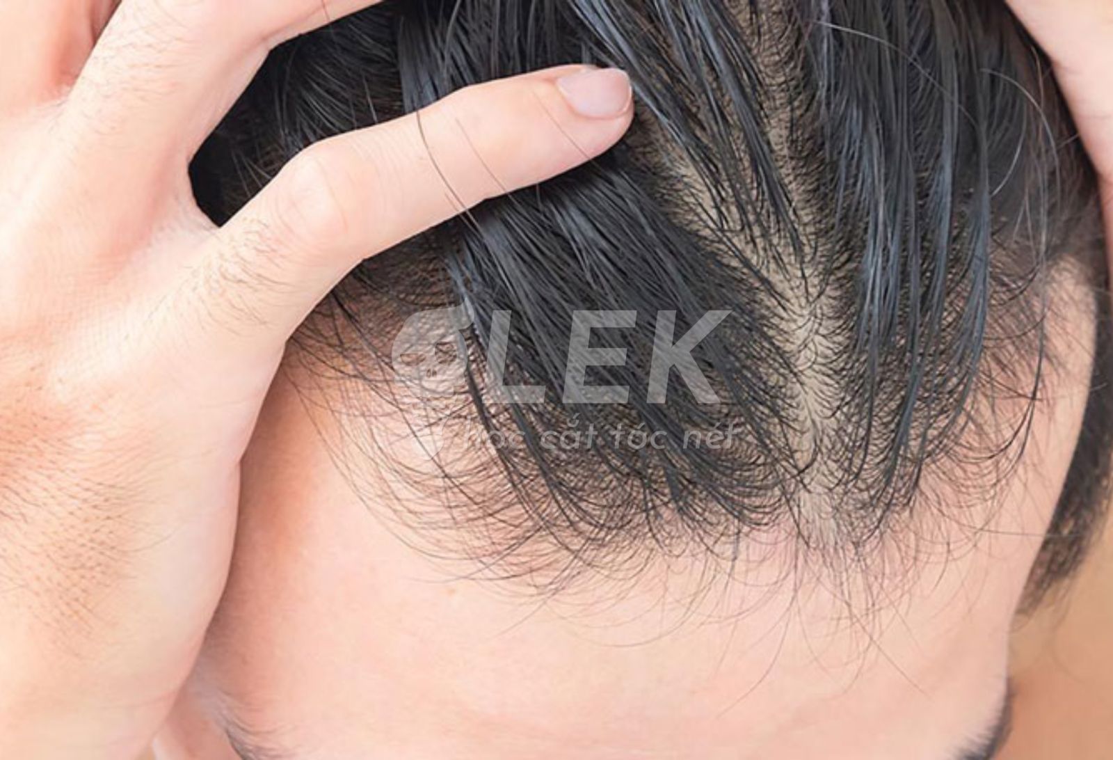 tóc nam mỏng