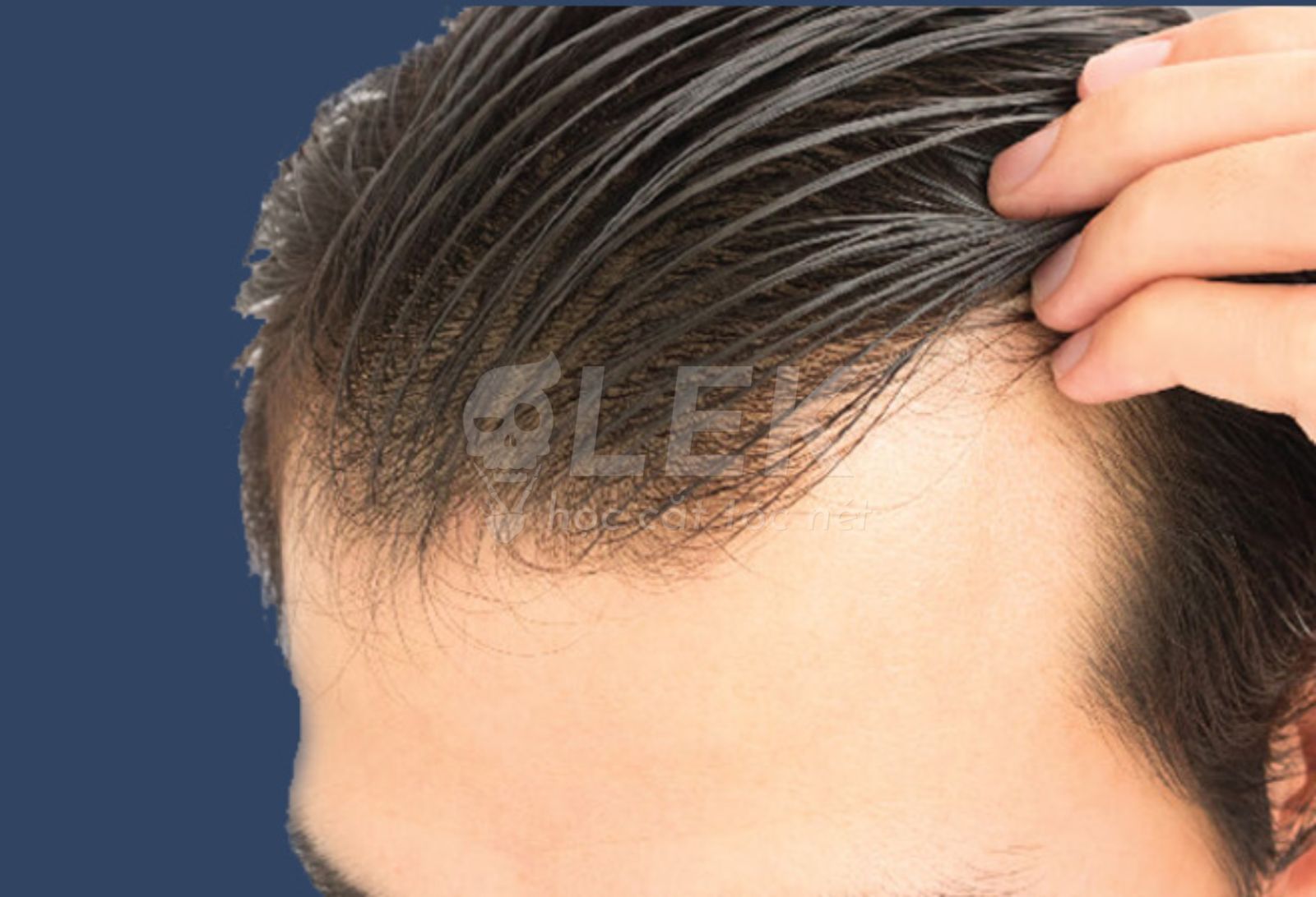 Tóc nam nhanh bết