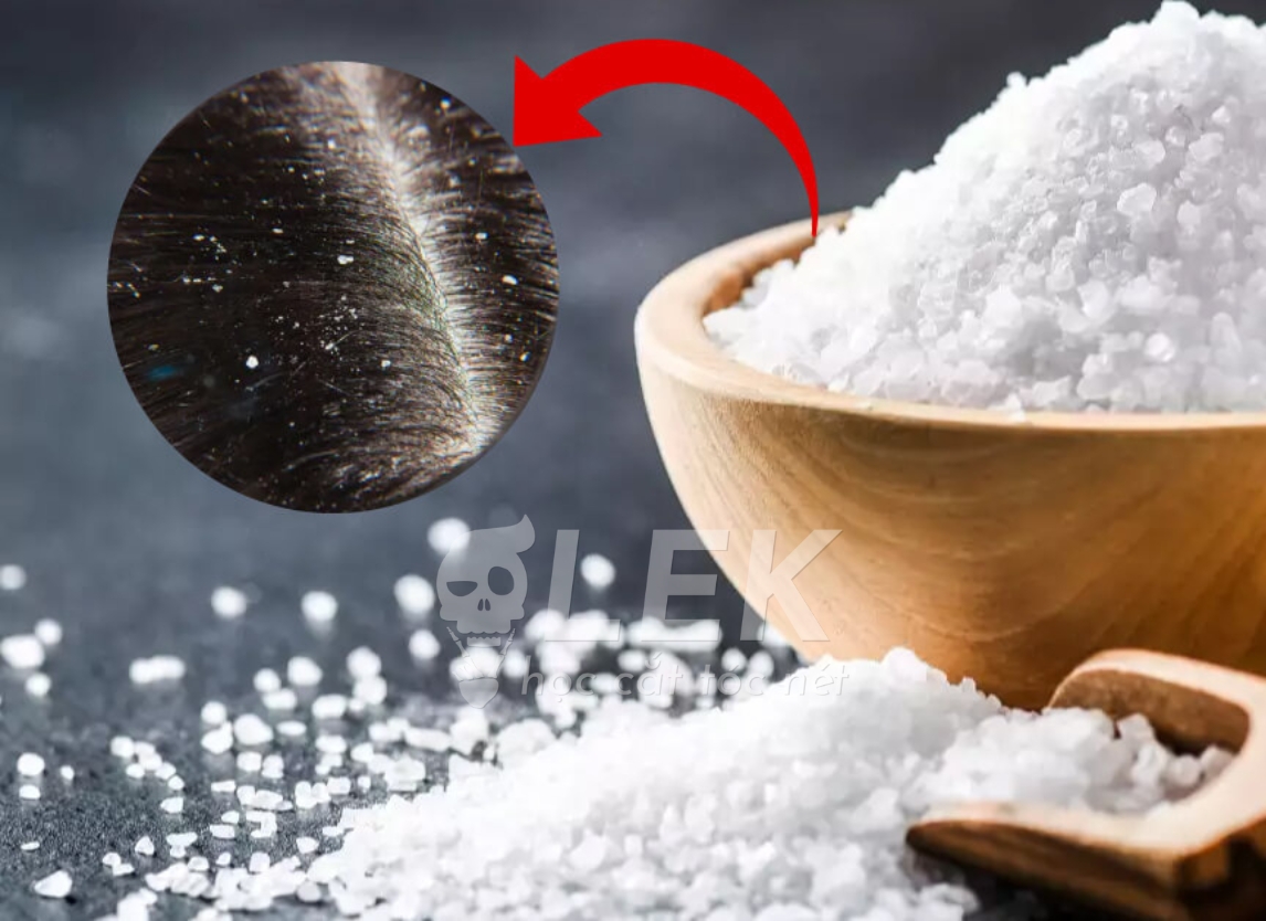 Cách trị gàu