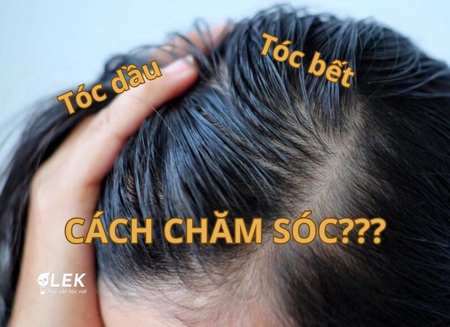 Chăm sóc tóc dầu cho nam